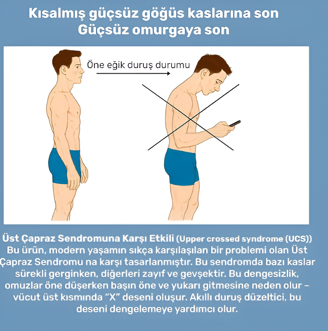 Şarjlı Titreşimli Otomatik Kamburluk Giderici Ergonomik Akıllı Duruş Düzeltici (Mavi)